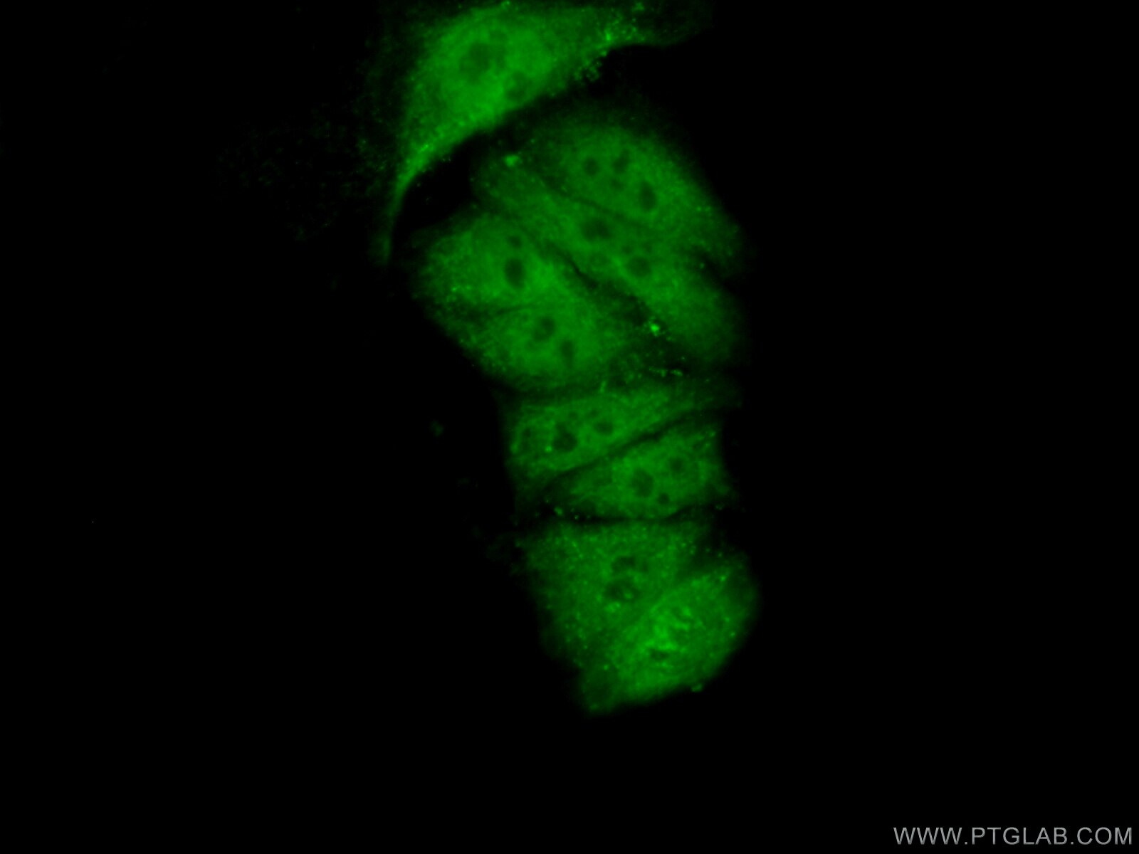 Immunofluorescence (IF) / fluorescent staining of HepG2 cells using FAM98B Polyclonal antibody (22251-1-AP)