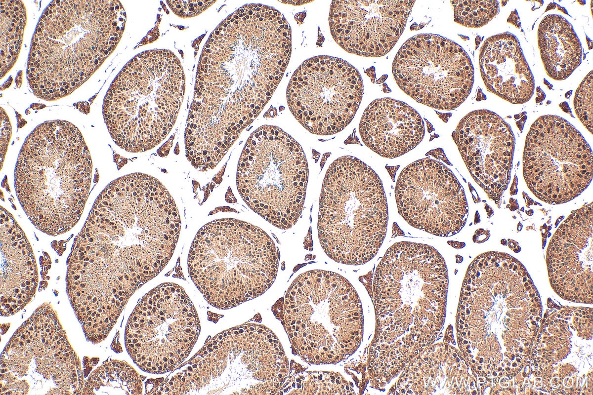 Immunohistochemistry (IHC) staining of mouse testis tissue using FAM98B Polyclonal antibody (22251-1-AP)