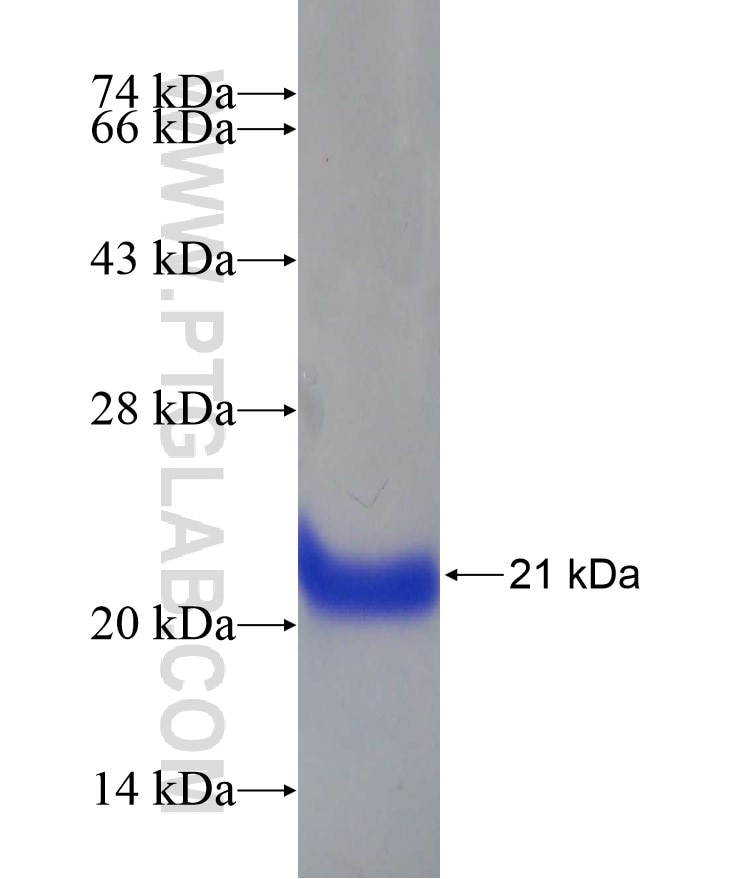 FAM98B fusion protein Ag17856 SDS-PAGE