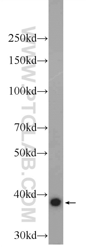 Western Blot (WB) analysis of A431 cells using FAM98C Polyclonal antibody (25274-1-AP)