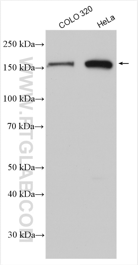Western Blot (WB) analysis of various lysates using FANCA Polyclonal antibody (11975-1-AP)