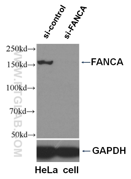Western Blot (WB) analysis of HeLa cells using FANCA Polyclonal antibody (11975-1-AP)