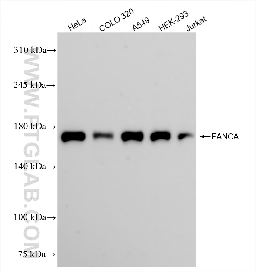 Western Blot (WB) analysis of various lysates using FANCA Recombinant antibody (84923-5-RR)