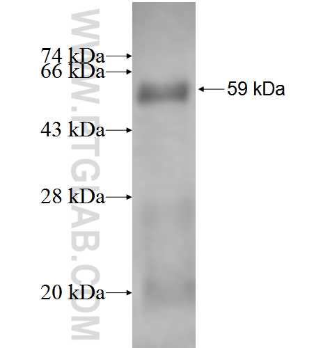 FANCA fusion protein Ag2598 SDS-PAGE