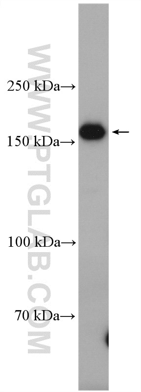 Western Blot (WB) analysis of HeLa cells using FANCA-Specific Polyclonal antibody (19542-1-AP)