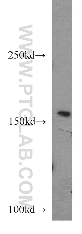 Western Blot (WB) analysis of HEK-293 cells using FANCA-Specific Polyclonal antibody (19542-1-AP)