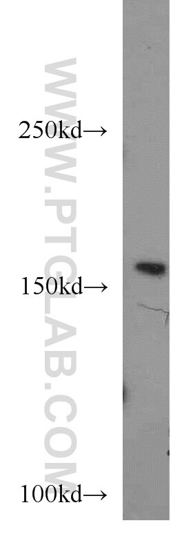 WB analysis of HEK-293 using 19542-1-AP