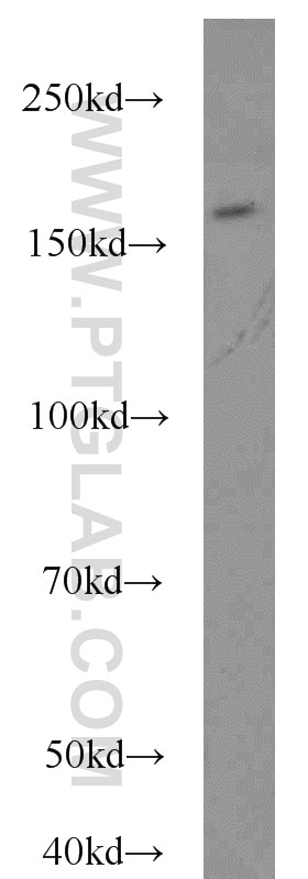 Western Blot (WB) analysis of HeLa cells using FANCA-Specific Polyclonal antibody (19542-1-AP)
