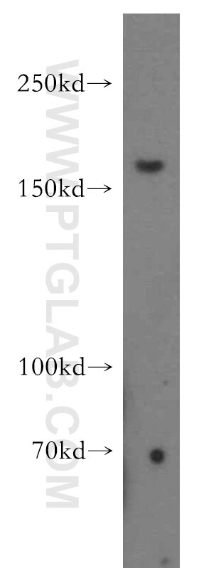 FANCA-Specific Polyclonal antibody