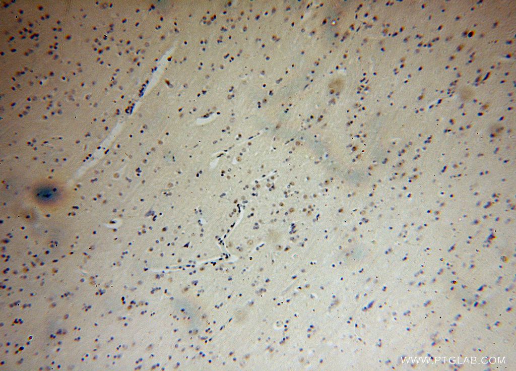 Immunohistochemistry (IHC) staining of human brain tissue using FANCC Polyclonal antibody (16973-1-AP)