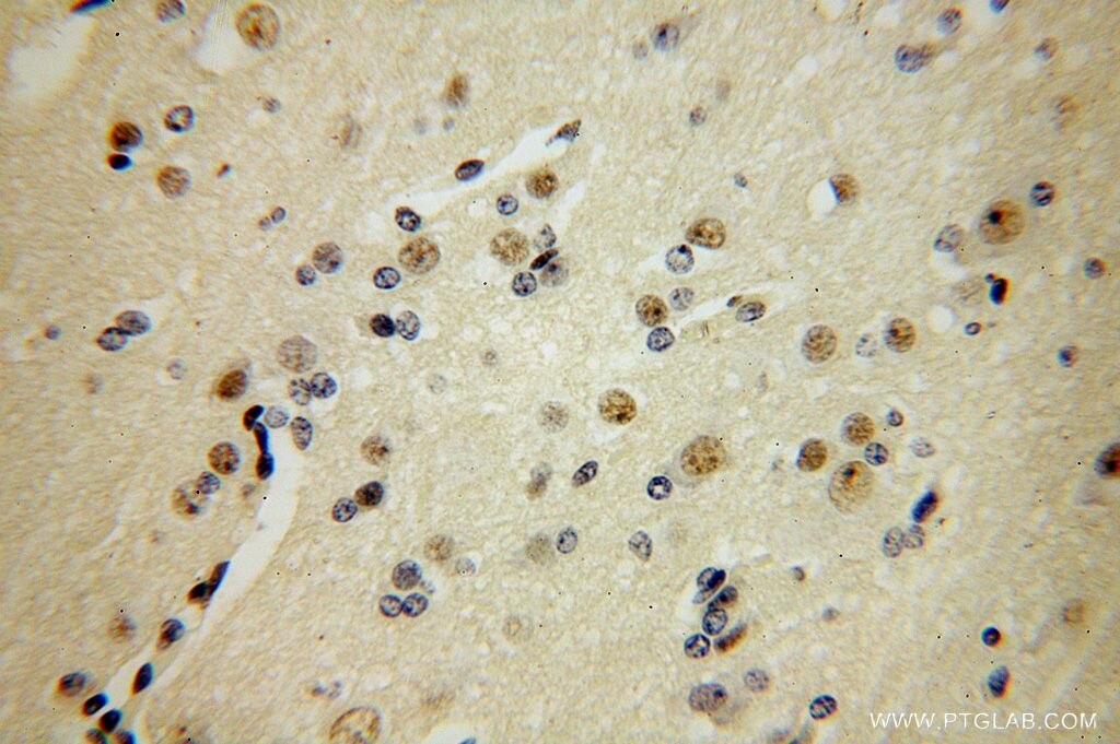 Immunohistochemistry (IHC) staining of human brain tissue using FANCC Polyclonal antibody (16973-1-AP)