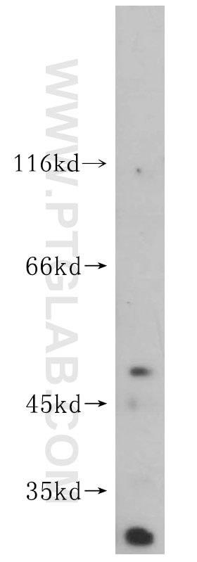 Western Blot (WB) analysis of K-562 cells using FANCC Polyclonal antibody (16973-1-AP)