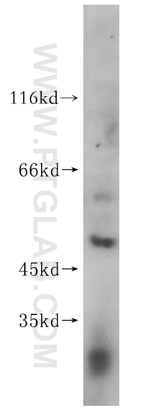 Western Blot (WB) analysis of Jurkat cells using FANCC Polyclonal antibody (16973-1-AP)
