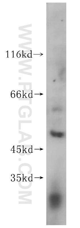 WB analysis of Jurkat using 16973-1-AP