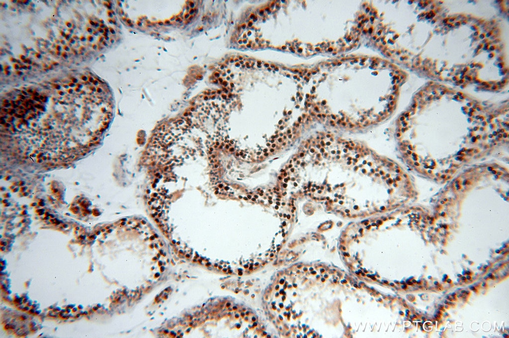 Immunohistochemistry (IHC) staining of human testis tissue using Phospho-FANCD2 (Ser330) Polyclonal antibody (19543-1-AP)