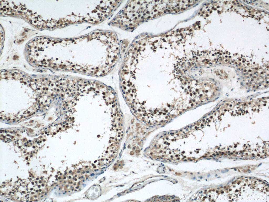 Immunohistochemistry (IHC) staining of human testis tissue using Phospho-FANCD2 (Ser330) Polyclonal antibody (19543-1-AP)