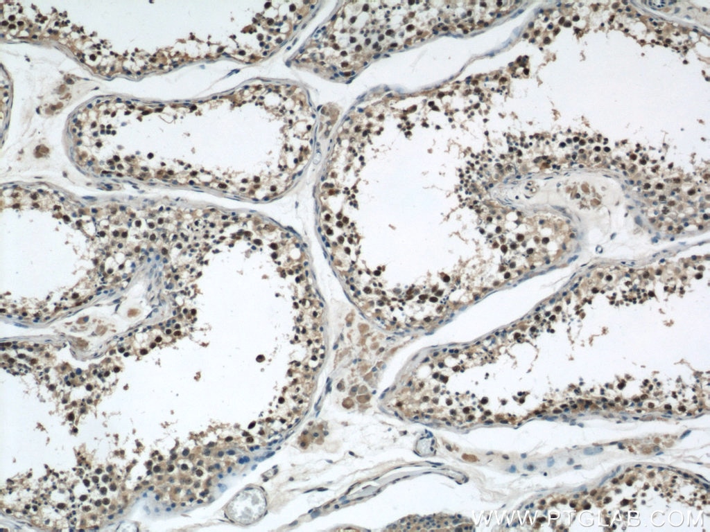 IHC staining of human testis using 19543-1-AP