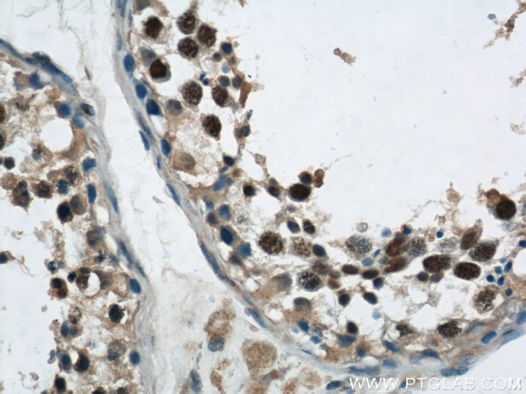 Immunohistochemistry (IHC) staining of human testis tissue using Phospho-FANCD2 (Ser330) Polyclonal antibody (19543-1-AP)