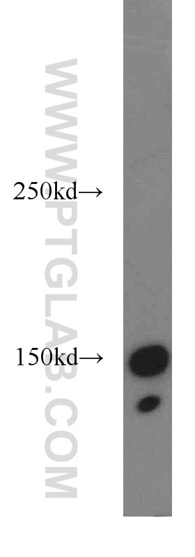 Western Blot (WB) analysis of HL-60 cells using Phospho-FANCD2 (Ser330) Polyclonal antibody (19543-1-AP)