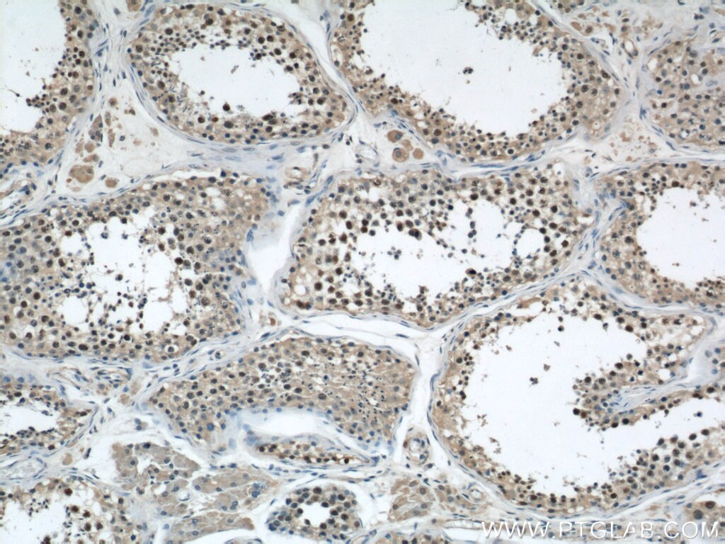 Immunohistochemistry (IHC) staining of human testis tissue using FANCD2 Polyclonal antibody (24006-1-AP)