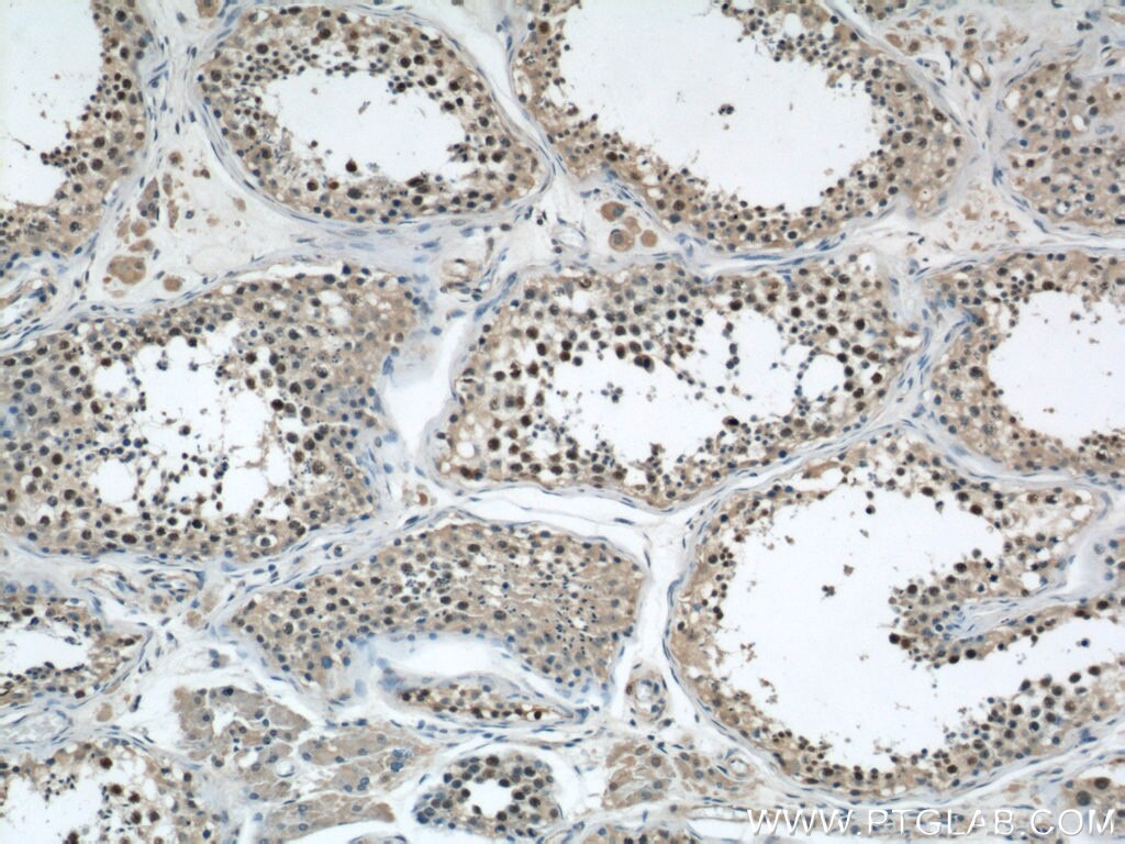 IHC staining of human testis using 24006-1-AP