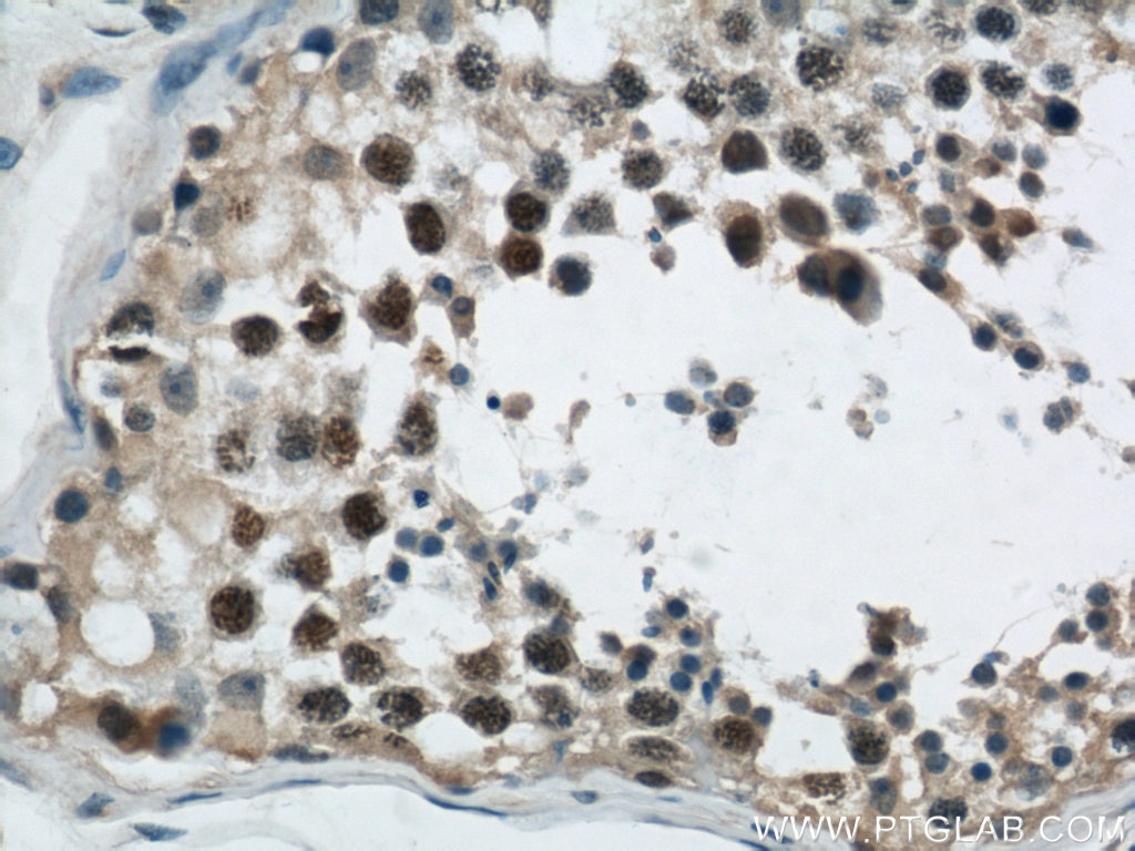 Immunohistochemistry (IHC) staining of human testis tissue using FANCD2 Polyclonal antibody (24006-1-AP)