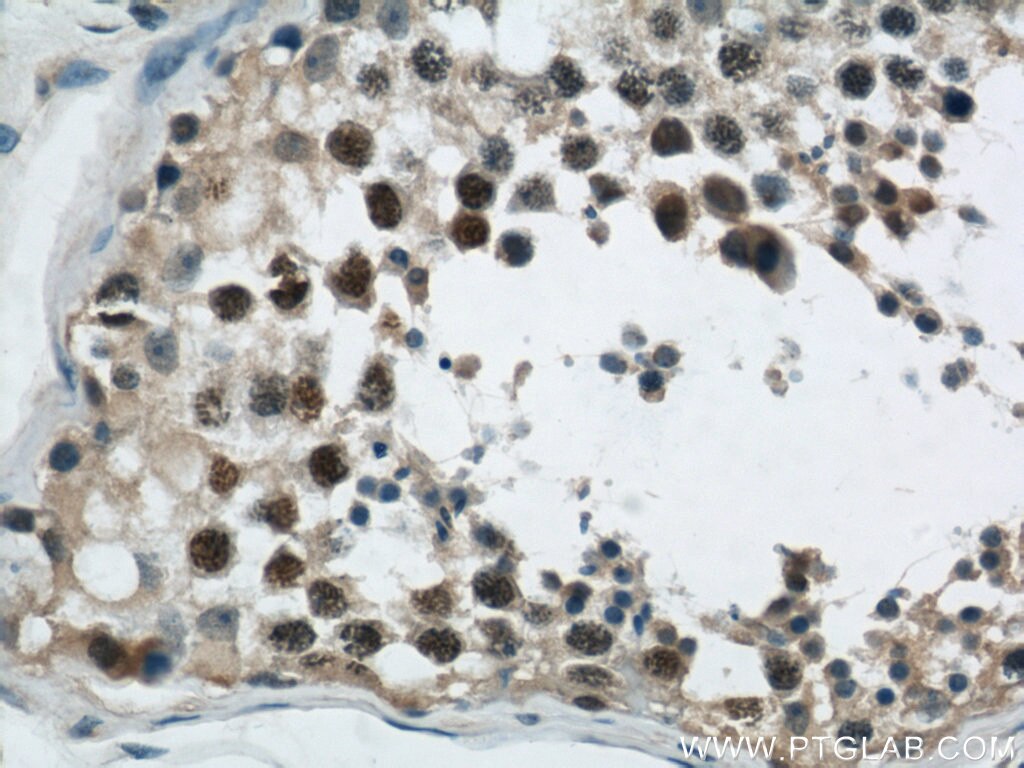 IHC staining of human testis using 24006-1-AP