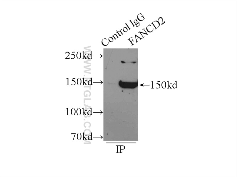 Immunoprecipitation (IP) experiment of mouse testis tissue using FANCD2 Polyclonal antibody (24006-1-AP)