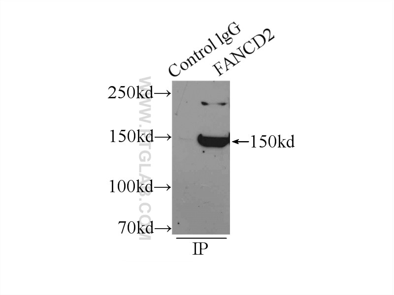 IP experiment of mouse testis using 24006-1-AP