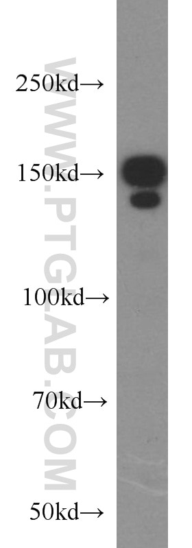 Western Blot (WB) analysis of HL-60 cells using FANCD2 Polyclonal antibody (24006-1-AP)