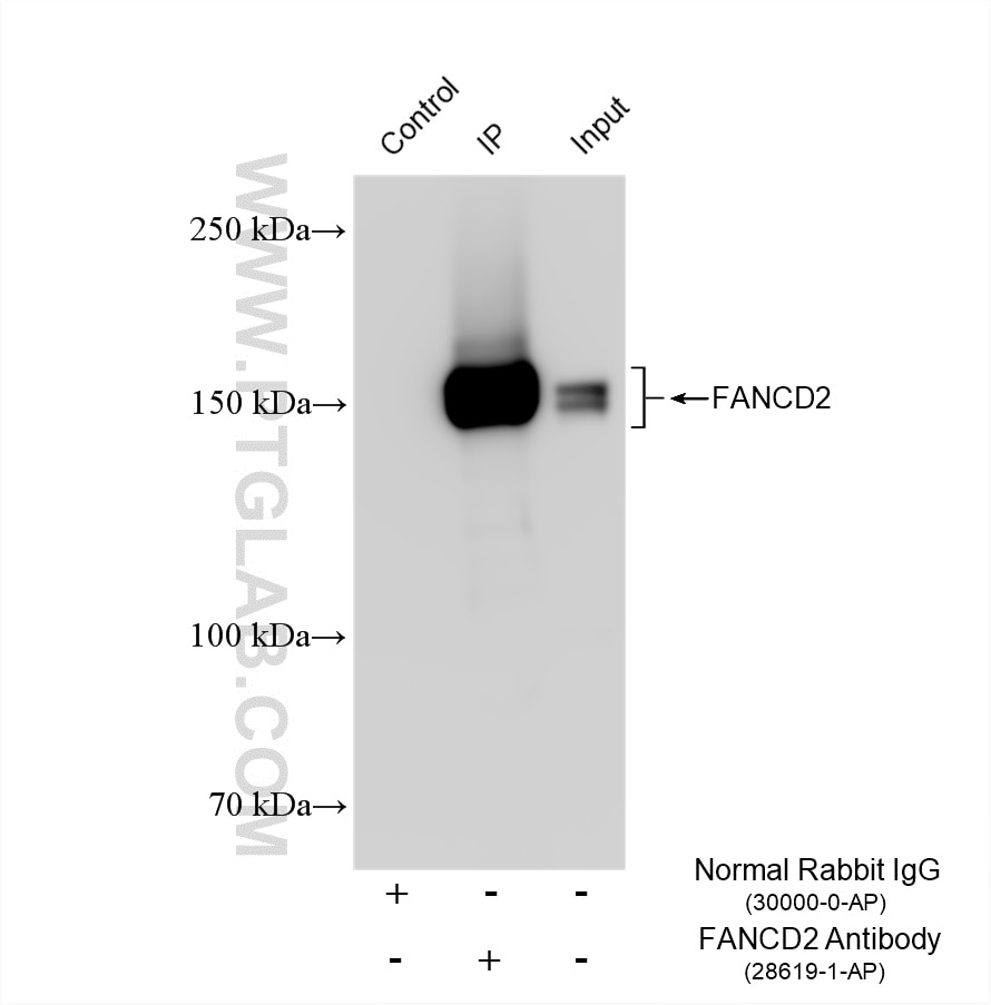 Immunoprecipitation (IP) experiment of K-562 cells using FANCD2 Polyclonal antibody (28619-1-AP)