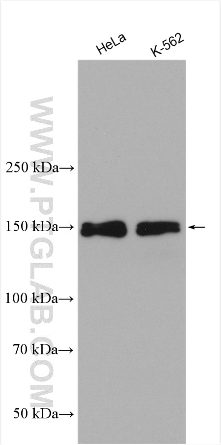 Western Blot (WB) analysis of various lysates using FANCD2 Polyclonal antibody (28619-1-AP)