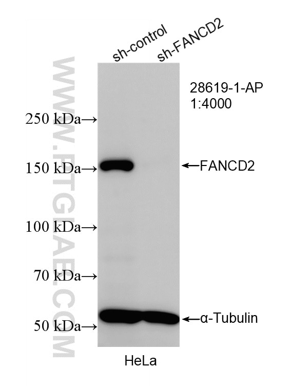 WB result of FANCD2 antibody (28619-1-AP; 1:4000; incubated at room temperature for 1.5 hours) with sh-Control and sh-FANCD2 transfected HeLa cells. Western Blot (WB) analysis of HeLa cells using FANCD2 Polyclonal antibody (28619-1-AP)