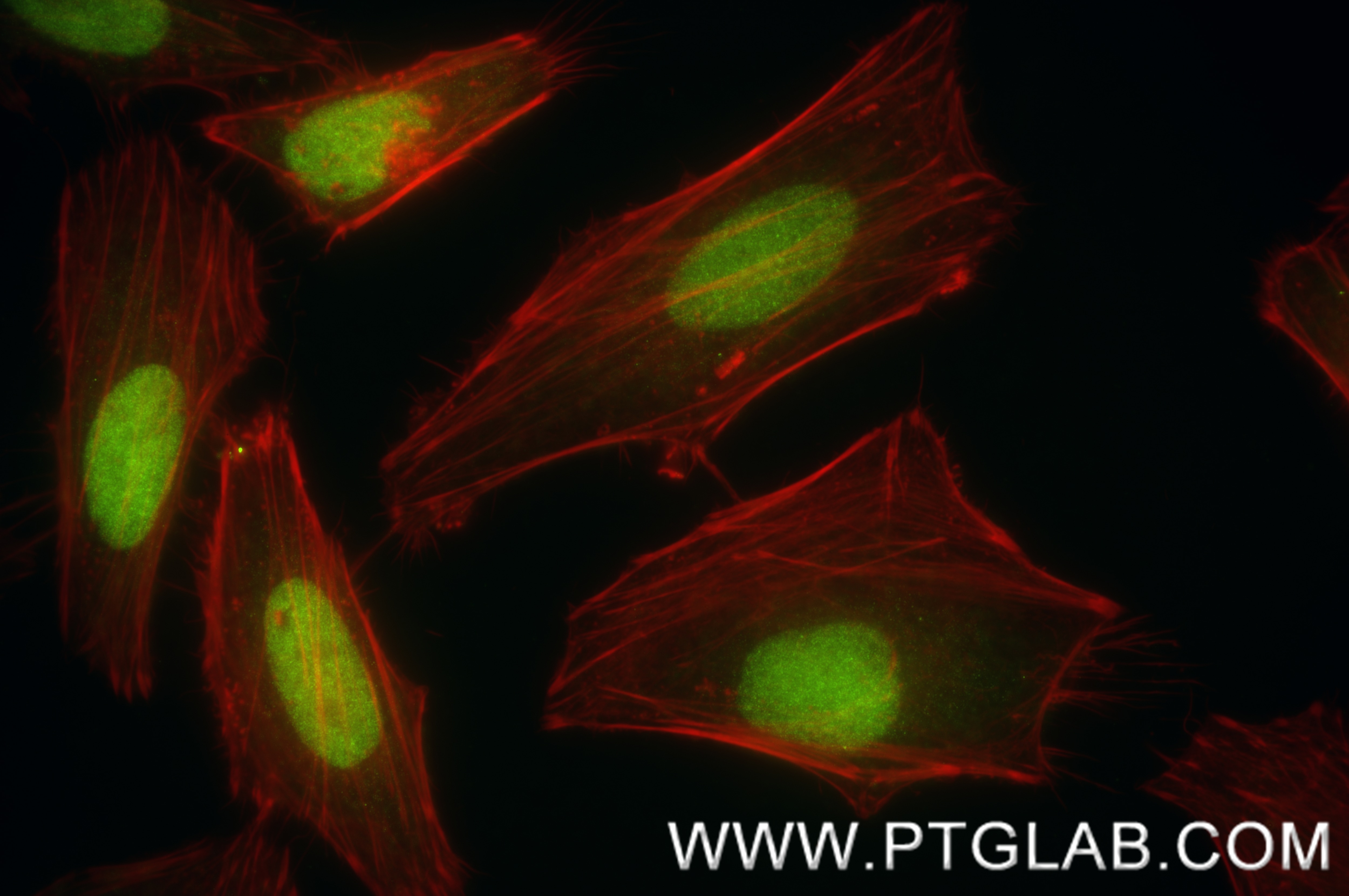 Immunofluorescence (IF) / fluorescent staining of HeLa cells using FANCD2 Recombinant antibody (83946-4-RR)