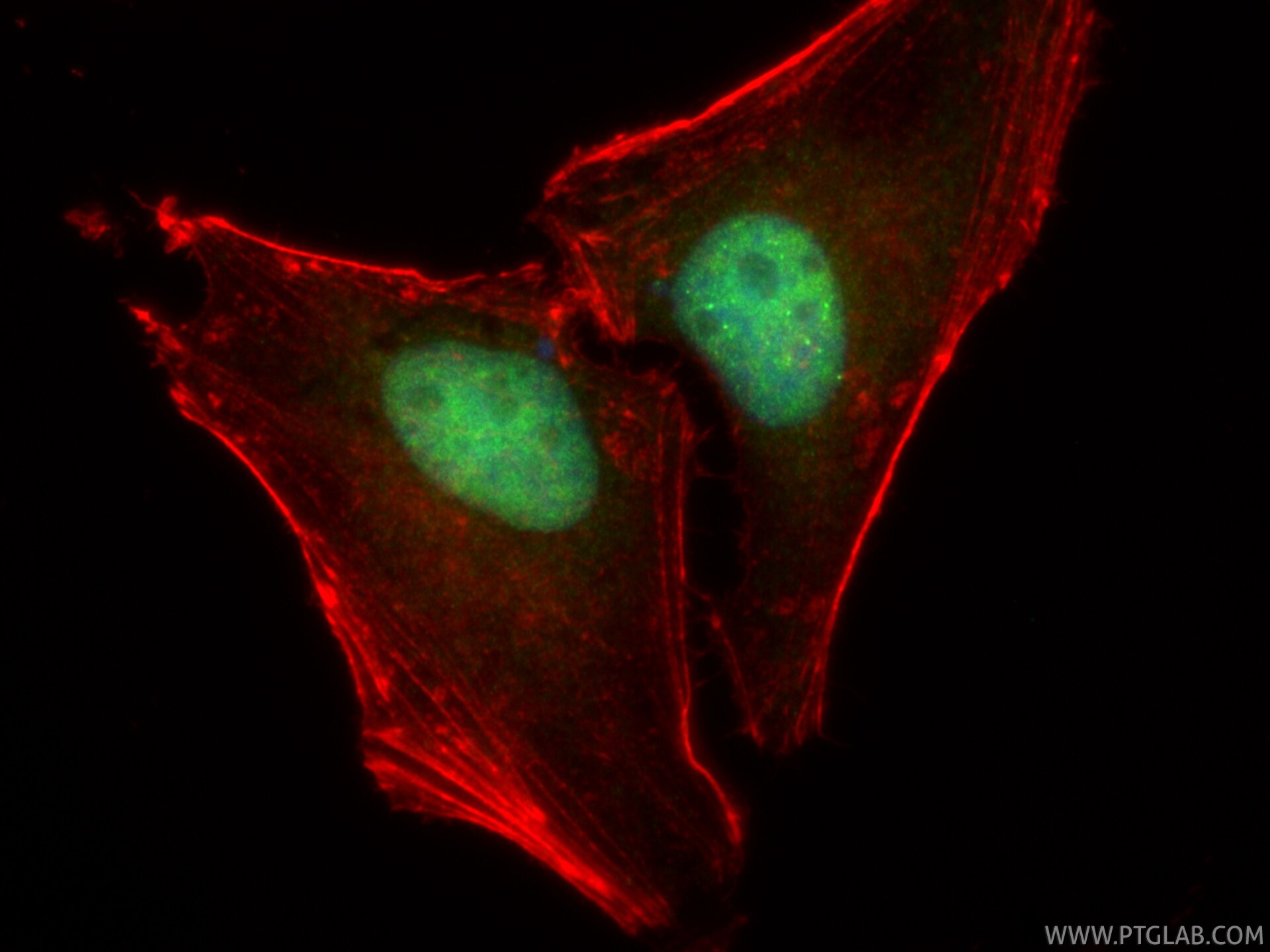 Immunofluorescence (IF) / fluorescent staining of HeLa cells using FANCD2 Recombinant monoclonal antibody (83946-4-RR)
