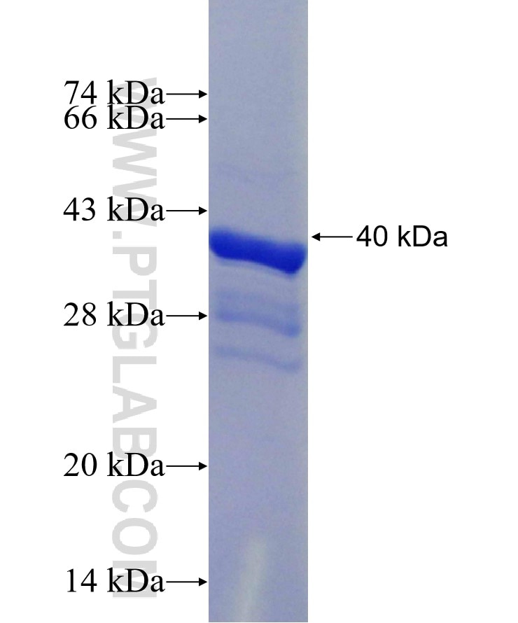 FANCD2 fusion protein Ag29460 SDS-PAGE