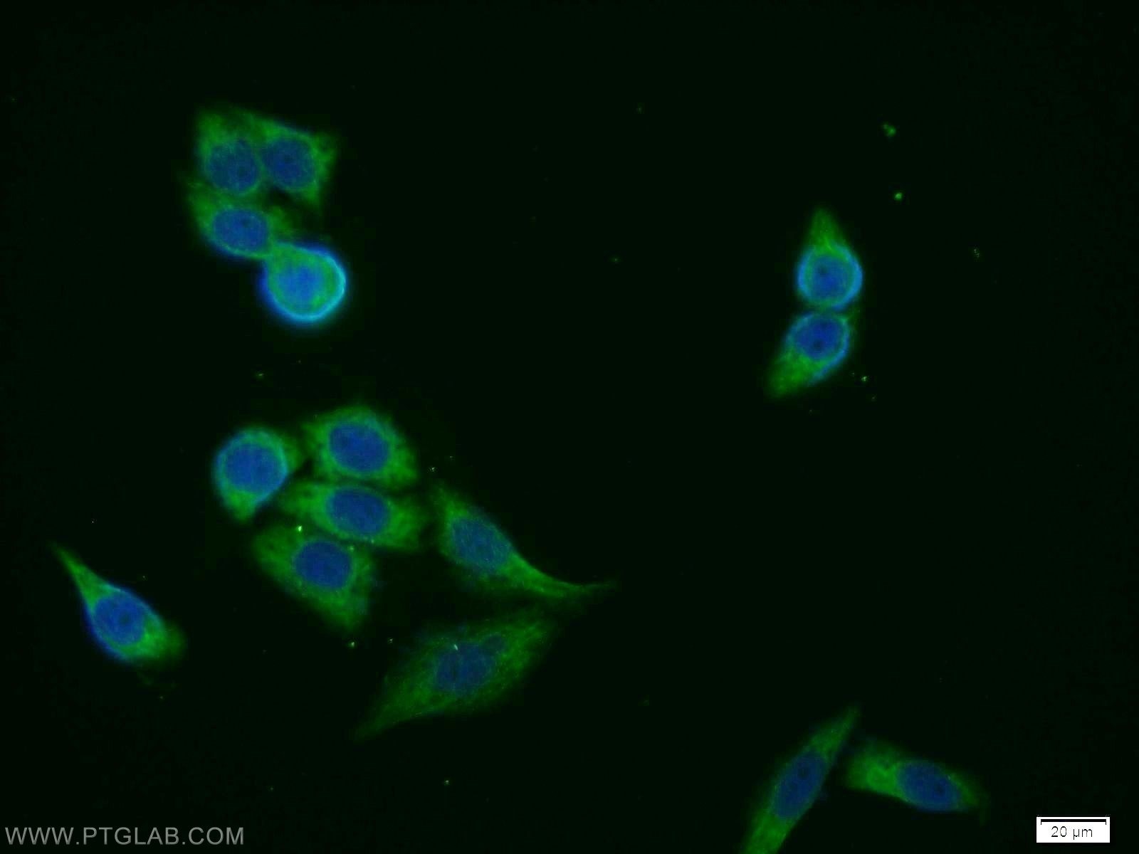 Immunofluorescence (IF) / fluorescent staining of HeLa cells using FANCG Polyclonal antibody (10215-1-AP)