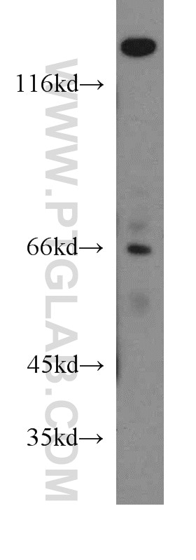 Western Blot (WB) analysis of mouse testis tissue using FANCG Polyclonal antibody (10215-1-AP)
