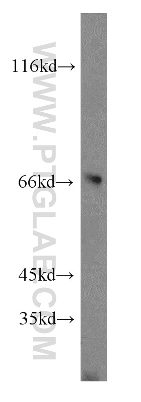 Western Blot (WB) analysis of K-562 cells using FANCG Polyclonal antibody (10215-1-AP)