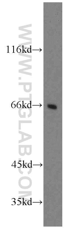 Western Blot (WB) analysis of HeLa cells using FANCG Polyclonal antibody (10215-1-AP)