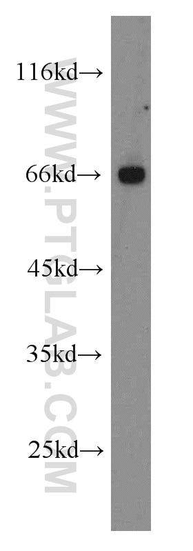 Western Blot (WB) analysis of Jurkat cells using FANCG Polyclonal antibody (10215-1-AP)