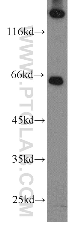Western Blot (WB) analysis of mouse thymus tissue using FANCG Polyclonal antibody (10215-1-AP)