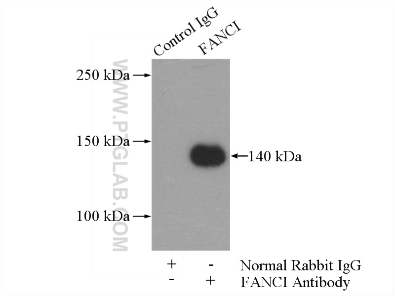 Immunoprecipitation (IP) experiment of Jurkat cells using FANCI Polyclonal antibody (20789-1-AP)