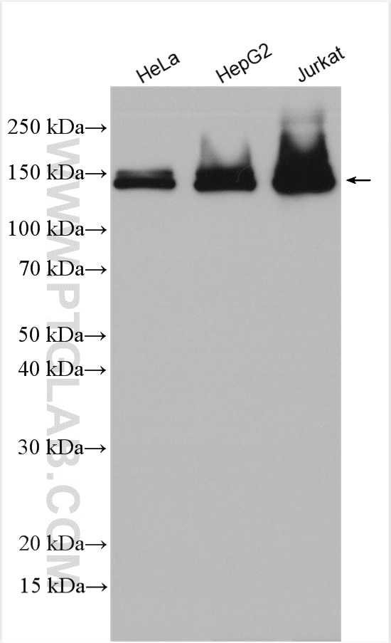 Western Blot (WB) analysis of various lysates using FANCI Polyclonal antibody (20789-1-AP)