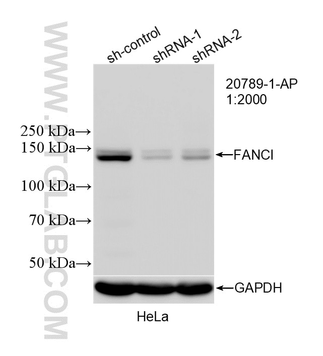 WB result of FANCI antibody (20789-1-AP; 1:2000; incubated at room temperature for 1.5 hours) with sh-Control and sh-FANCI transfected HeLa cells. Western Blot (WB) analysis of HeLa cells using FANCI Polyclonal antibody (20789-1-AP)