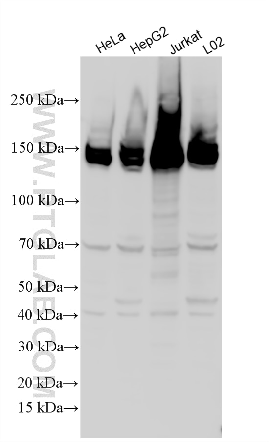 WB analysis using 20789-1-AP Western Blot (WB) analysis of various lysates using FANCI Polyclonal antibody (20789-1-AP)