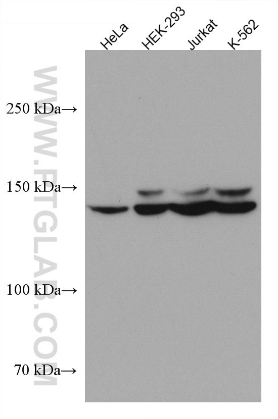 Western Blot (WB) analysis of various lysates using FANCI Monoclonal antibody (67304-1-Ig)