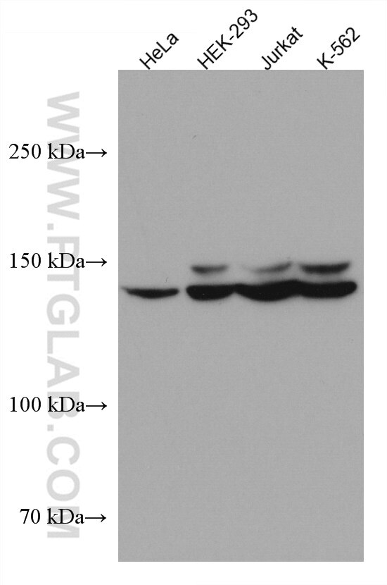 Western Blot (WB) analysis of various lysates using FANCI Monoclonal antibody (67304-1-Ig)