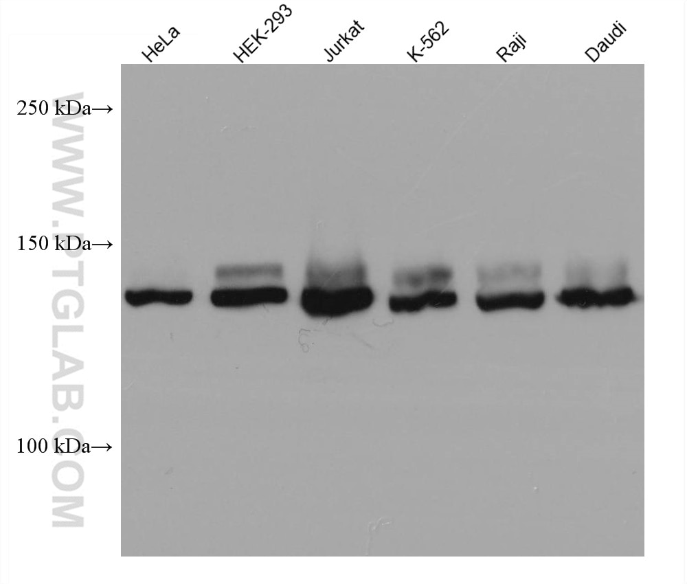 Western Blot (WB) analysis of various lysates using FANCI Monoclonal antibody (67304-1-Ig)