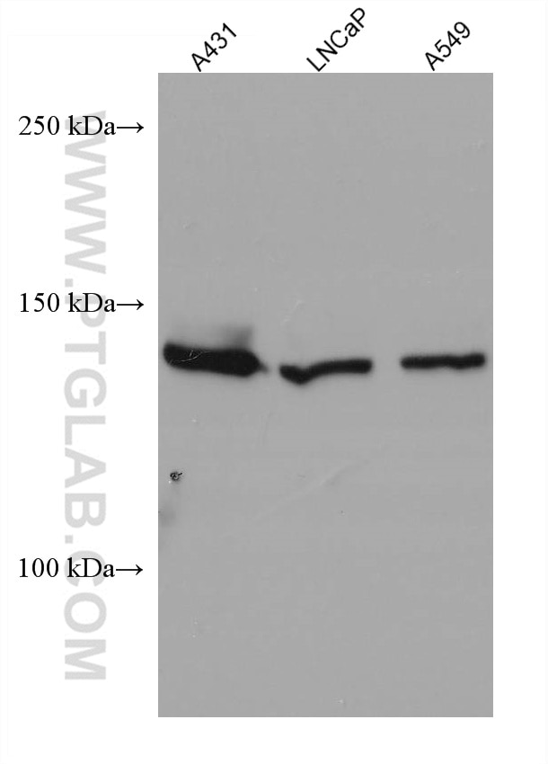Western Blot (WB) analysis of various lysates using FANCI Monoclonal antibody (67304-1-Ig)